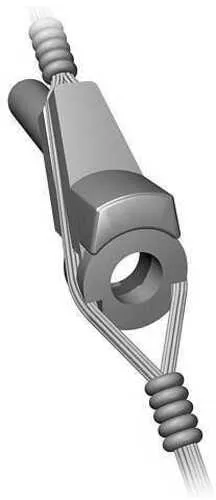 Radical Archery Designs Inc. Tru-Aligner Ultra Peep Aligner 29067